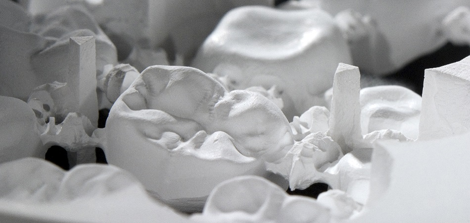 Digital dental milling workflow