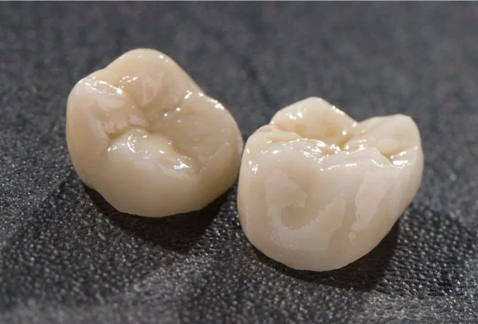 Dental crown restorations for Tennessee dental practices